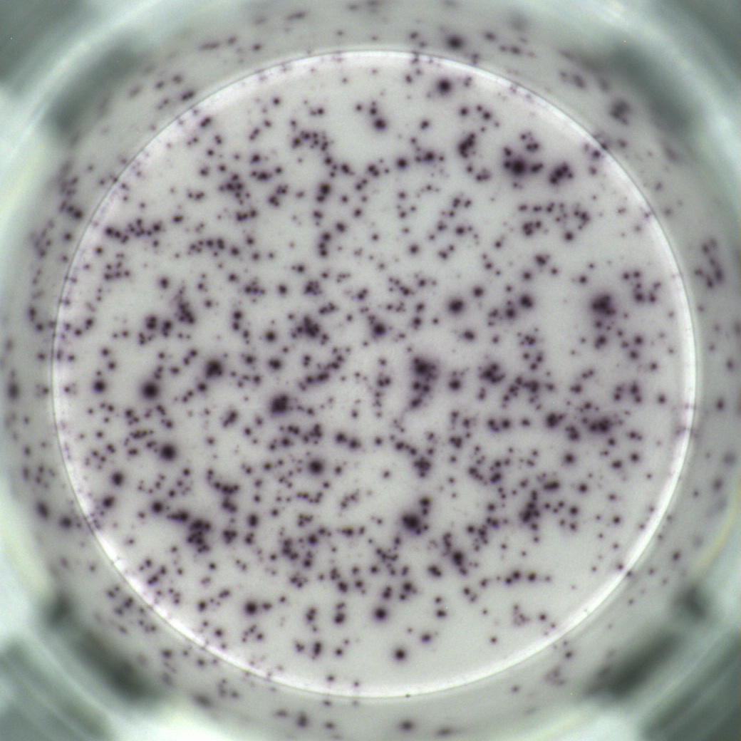 T cell complete